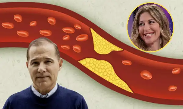 CARA FAGNANI, IL COLESTEROLO È UNA COSA SERIA, LASCIAMO PARLARE CHI SE NE INTENDE